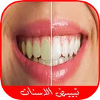 خلطات تبييض الأسنان طبيعيا