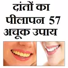 दातो का पीलापन - 57 घरेलू उपाय